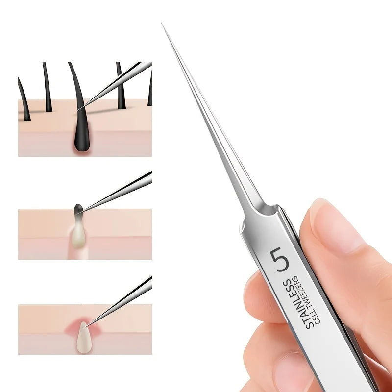 Acne Blackhead Tweezer