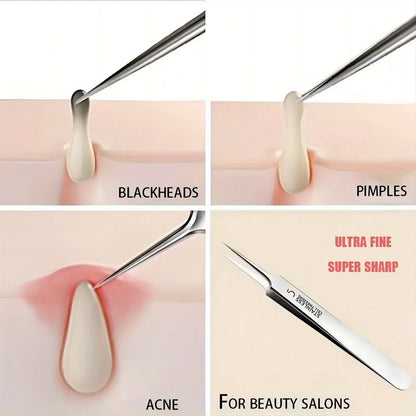 Acne Blackhead Tweezer